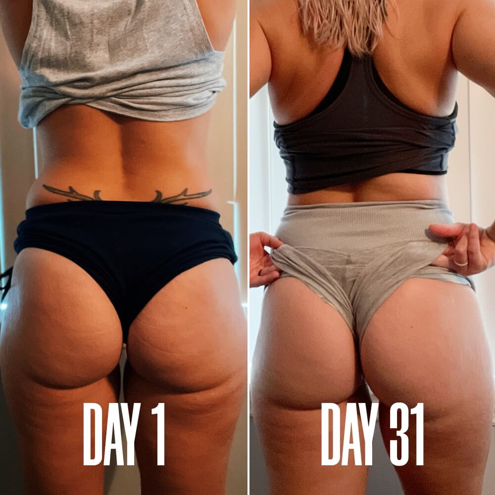 The Cellulite Duo package